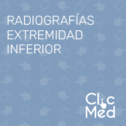 Radiografías Extremidad Inferior – ClicMed