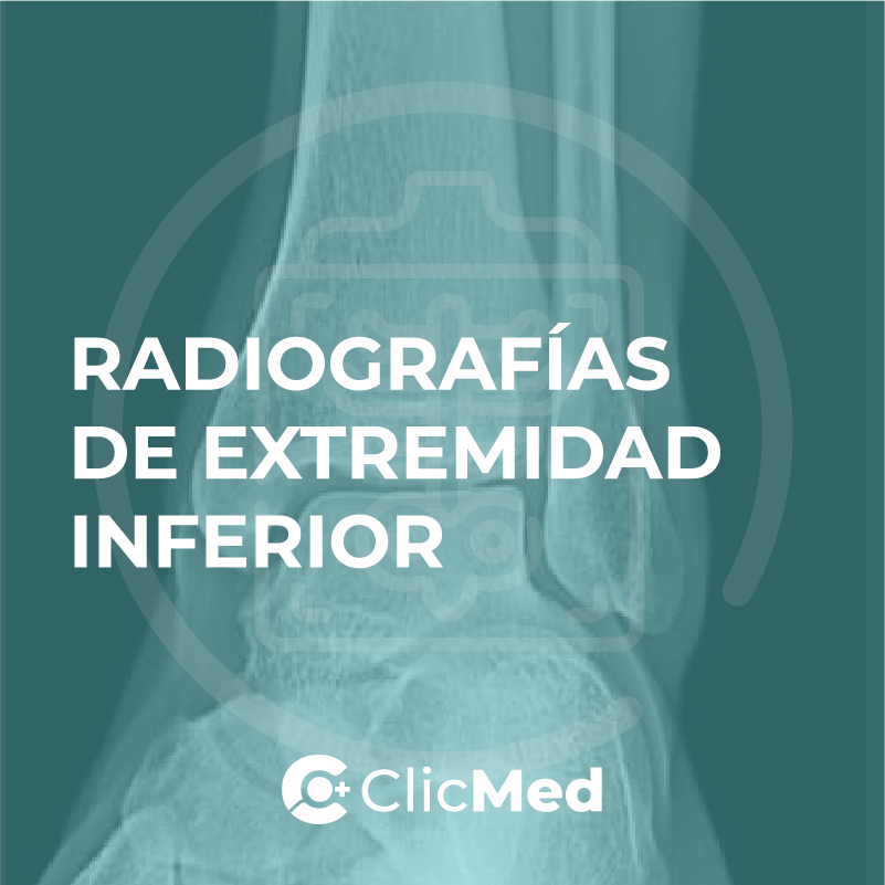 Orden de examen radiografías Extremidad Inferior