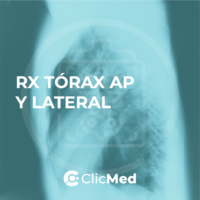 Orden de examen radiografía Tórax AP Y Lateral